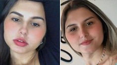 Prvé na svete. Brazílske dvojičky podstúpili simultánnu zmenu pohlavia