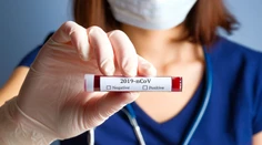 Počet nakazených koronavírusom sa blíži k miliónu. Pandémia zasiahla polovicu sveta