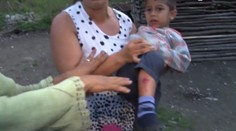 Premnožené psy v osade si vybrali svoju daň. Dohrýzli štvorročného chlapca