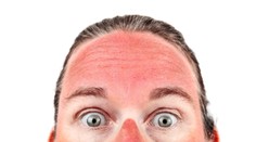 Pozor na zákerné slnko. Môže spôsobiť mnoho ťažkostí