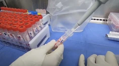Nový kmeň vtáčej chrípky má prvú ľudskú obeť. Zisťovali sme, či sa máme niečoho obávať