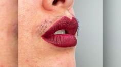 Fotka, ktorá vzbudila ošiaľ. Chĺpky na tvári sú normálne a nemusíte sa za ne hanbiť, tvrdí autorka