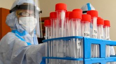 Väčšina nových prípadov COVID-19 sú kontakty z podchytených ohnísk, najmä rodinných osláv