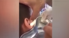 Chlapca trápila bolesť ucha. Doktor si musel poradiť s larvami