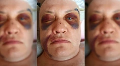 Mariána mal vraj takto doriadiť policajt v sanitke