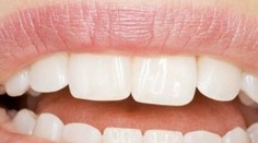 Páchne vám z úst? Tieto rady vám pomôžu