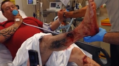 Zapálil si elektronickú cigaretu a...Bum!