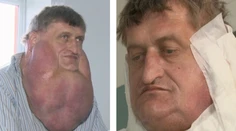 V Martine z tohto muža urobili opäť toho, kým bol