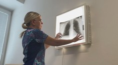 Dlhé čakacie lehoty, málo pľúcnych lekárov. V Banskobystrickom kraji končia viacerí pneumológovia, hovoria o kríze