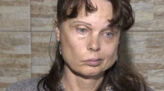 Dva mesiace mala vkuse otvorené oko. Hrozilo jej oslepnutie, ale s operáciou čakali