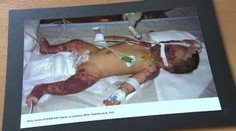 Vražedné osýpky, mumps či čierny kašeľ. Strašiaci minulosti sú späť