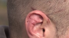 Sklamanie v láske riešil s nožom v ruke. Útočník stále behá po slobode