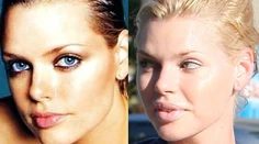 Krásna modelka to prehnala s plastikami. Vyzerá ako Joker z Batmana