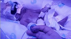 Zázračné bábätko: Narodilo sa o tri mesiace skôr, prekonalo baktériu, otravu krvi aj covid