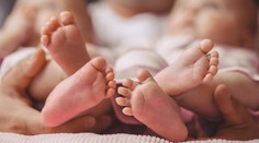 Veľký úspech lekárov. Podarilo sa im oddeliť len deväťmesačné siamské dvojičky, zrastené boli bruchom