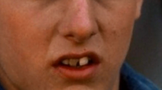 Vtedy a dnes zuby hollywoodskych hviezd: S takým úsmevom by svet rozhodne neočarili