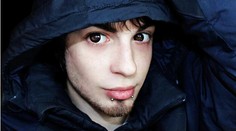 Muž (25) minul takmer 30-tisíc eur, aby vyzeral ako elf. Pozrite si výsledok