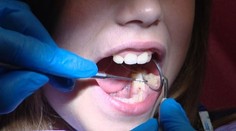 Návšteva u lekára dopadla katastrofálne. Dá sa reklamovať zbabraný zákrok?