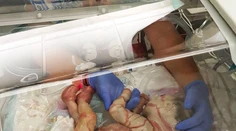 Keď sa narodila, nevyzerala ako človek. Napriek zlej prognóze oslávi prvý rok
