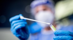 Počet hospitalizovaných značne klesol, koronavírusu podľahlo 48 pacientov