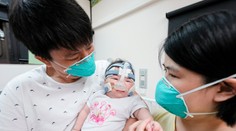 Najmenšie narodené dieťa na svete ide domov. V nemocnici strávilo prvý rok života