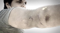 Krvavá dráma: Rozbesnený pes zaútočil na mladú matku a jej trojročnú dcéru