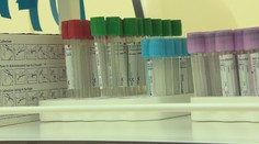 Pribudlo najmenej pozitívnych za tento týždeň, ale aj deväť úmrtí