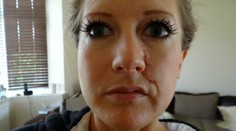 Chcela byť krásna, teraz je nešťastná. Solárium Britke spôsobilo rakovinu