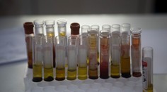 Tehotné ženy na Floride budú mať zadarmo prístup k testom na vírus zika