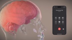 Vďaka čipu budú môcť ovládať mobil len pomocou mysle. Muskova spoločnosť chce pomáhať ťažko postihnutým komunikovať