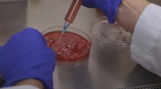 Chemoterapia už nebude potrebná. Je tu účinný liek na rakovinu!