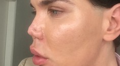 Živý Ken skončil s plastikami. Objavil si diery v nose