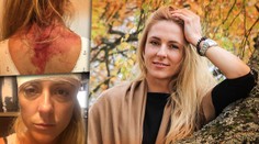 Manžel ju roky týral: Desí ma, koľko žien sa mi ozvalo. Potrebujú pomoc, no ja už nevládzem