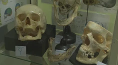 Naše telo dokáže pomáhať aj po smrti. Darovať ho na vedecké účely u nás nie je bežné