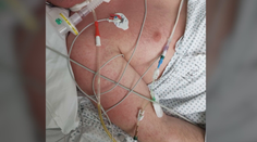 Život sa zmenil v sekunde. Športovec a otec malej dcérky zostal po nehode pripútaný na lôžko