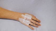 Fyzicky bola zdravá, no túžila zomrieť. Mladá Holanďanka s vážnymi psychickými problémami podstúpila eutanáziu