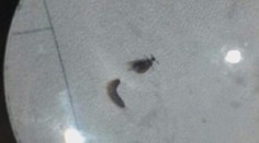 Stredoškoláčky prežívajú na internáte peklo: Po izbe sa im premávajú chrobáky