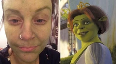 Použila samoopaľovák, skončila ako Fiona zo Shreka