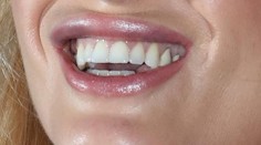 Manželka slávneho režiséra s čerstvo napichanými perami