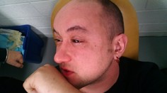 Experiment sa podaril! Vďaka chemikálii vidí tento muž aj v tme