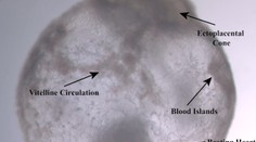 Fantastický pokrok: Vedci vypestovali embryá bez spermií a vajíčok