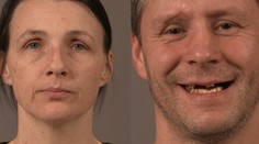 O 10 rokov mladší sa začína: Maroša a Máriu čaká úžasná zmena vizáže