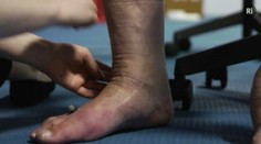 Nevyliečiteľné: Aj Slováci trpia chorobami ako zo seriálu Dr. House