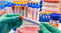 Francúzski vedci objavili nový variant koronavírusu. Do Európy sa dostal z Kamerunu