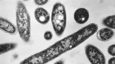 Legionella má v Poľsku už 22 obetí. Pôvod nákazy je stále záhadou