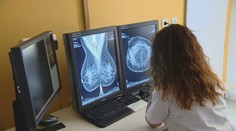 Rakovina u mladých je často zákernejšia a prognóza býva zlá. Lekári v ambulanciách liečia už aj dvadsiatnikov