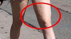 Len šesťnásťročnú Kylie Jenner trápi celulitída