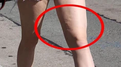 Len šesťnásťročnú Kylie Jenner trápi celulitída