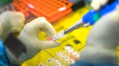 Peking pripustil, že vírus nepochádza zo živých zvierat z wuchanského trhu