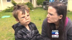 "Jedol ma!" Takto opísal chlapec (4) útok pitbulom
